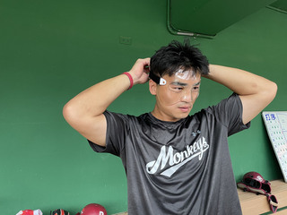 朱育賢被反彈球打斷鼻梁戴面罩 笑稱不用隆鼻了