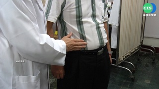 飲食改變脂肪肝患者增 醫籲調整飲食和運動