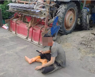 彰化警抓非法移工認錯人  少年遭勒頸撞傷縫17針