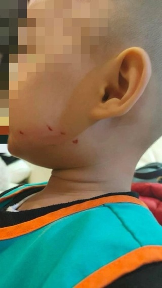 桃園市幼兒園再傳虐兒案  黃瓊慧批張善政只顧助選