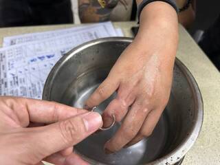 新北孕婦水腫鋼戒卡手指  消防員神救援解套