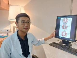 懷同卵雙胞胎防輸血症候群 增產檢次數保下小兄弟