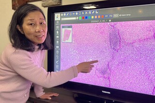 成大數位病理影像平台軟體 從學研走進實際應用