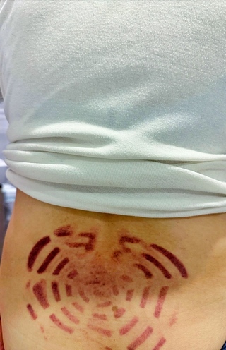 運動中心戲水遭吸出恐怖印痕  黃瓊慧要體育局改善