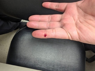 桃機檢疫員遭抽過血針頭扎  議員曝請假疑被刁難