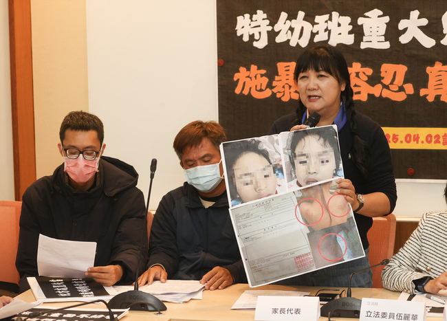 綠委爆台東某國小特教班兒虐 要求縣府說明後續調查 | 華視新聞