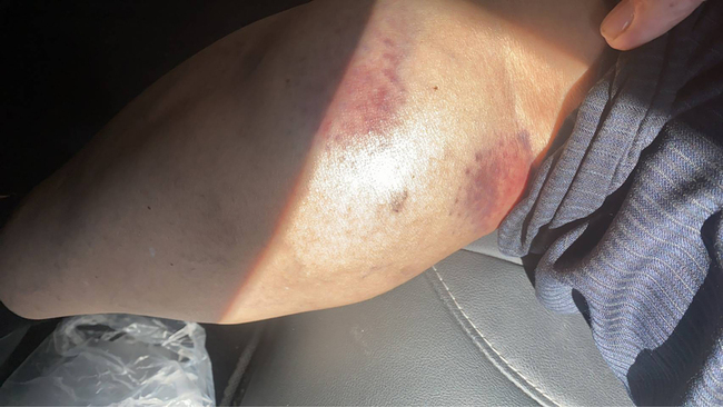 芳苑農會理事長遭人持球棒襲擊 彰警循線追查 | 華視新聞