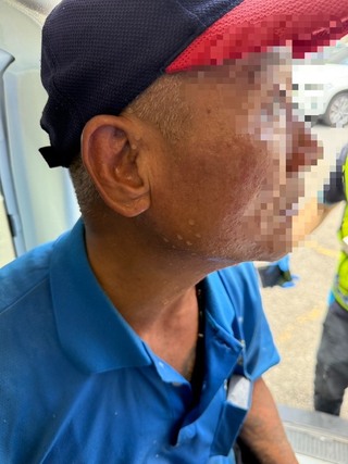 竹南科工廠外包工人遭鹼性廢液噴濺 3傷送醫