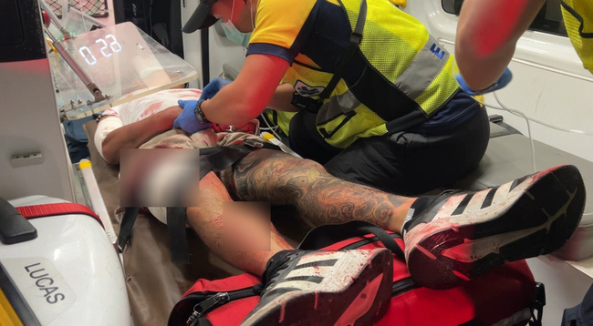 台東凌晨2幫人員械鬥  多人受槍刀傷送醫 | 華視新聞