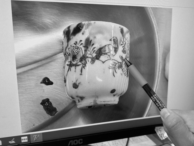 男無法解便就醫驚見肛門塞8公分高陶瓷杯　剖肚取出 | 華視新聞