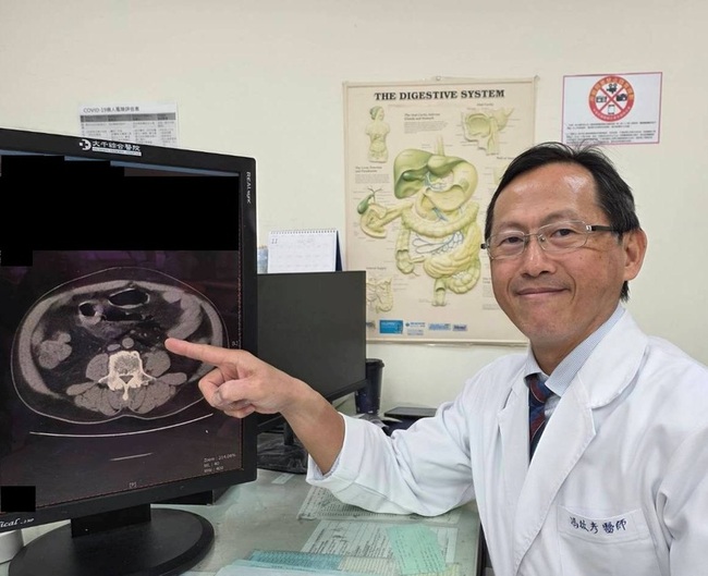 男子便秘三天兩頭自行灌腸　直腸破裂引發腹膜炎 | 華視新聞