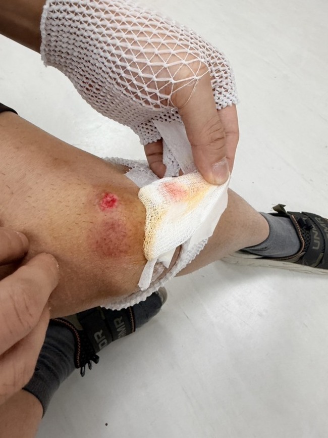 北市男通緝犯遇盤查逃逸遭逮、友人傷警　均送辦 | 華視新聞