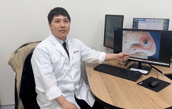 鼻上黑痣2年變大出血　老翁確診基底細胞癌 | 華視新聞