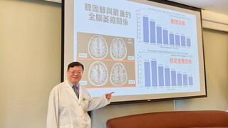 醫：研究顯示高齡族膽固醇過低恐增失智症惡化風險