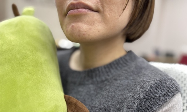 過年想美美見人　小心補過頭恐踩皮膚問題陷阱 | 華視新聞