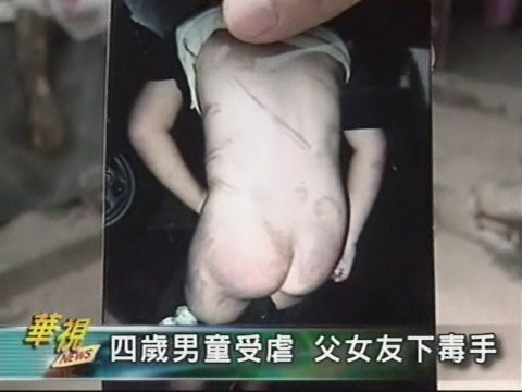 四歲男童受虐 父女友下毒手 | 華視新聞