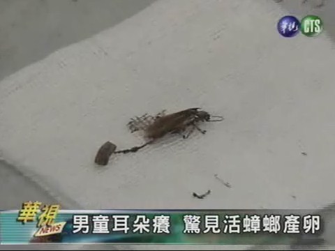 男童耳朵癢 驚見活蟑螂產卵 | 華視新聞