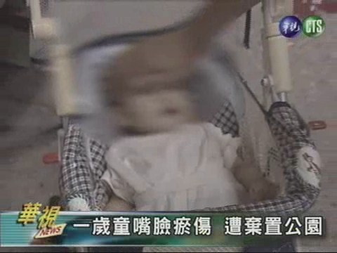 一歲童嘴臉瘀傷遭棄置公園 | 華視新聞
