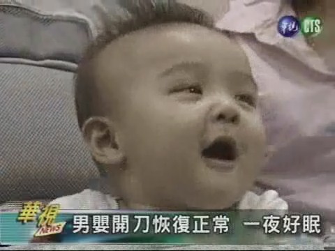 心臟血管繞氣管男嬰哭不停 | 華視新聞