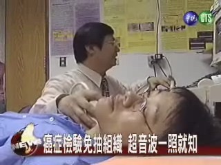 癌症檢驗免挨刀 超音波照便知 | 華視新聞