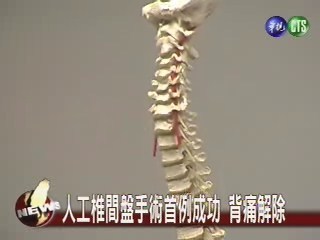 人工椎間盤 手術治療背痛