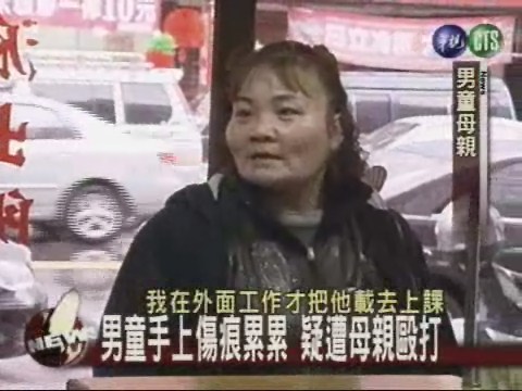 六歲男童受虐 疑遭母親毆打 | 華視新聞