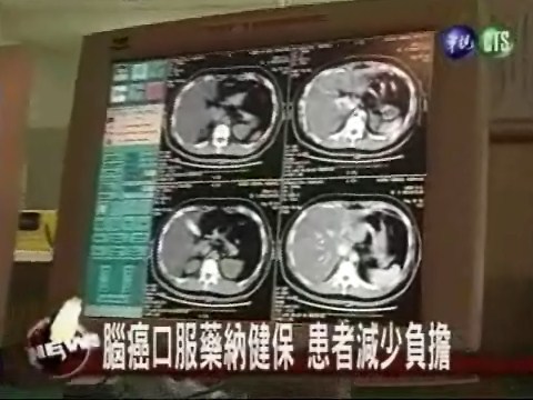 口服藥取代注射腦癌患壽命延長 | 華視新聞