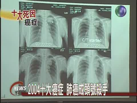 2004十大癌症 肺癌成頭號殺手 | 華視新聞