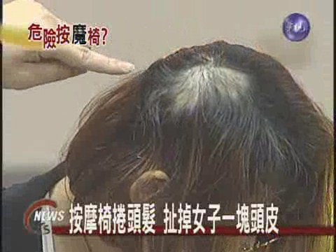 按摩椅捲頭髮 扯掉女子一塊頭皮 | 華視新聞