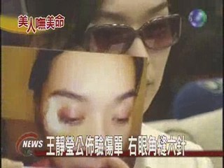 王靜瑩指控夫婿施暴 申請保護令