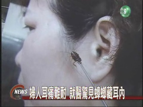 婦人耳痛就醫 驚見蟑螂鑽耳內 | 華視新聞