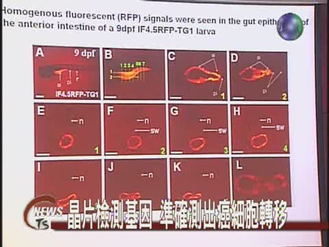 晶片檢測基因 準確測出癌細胞轉移 | 華視新聞