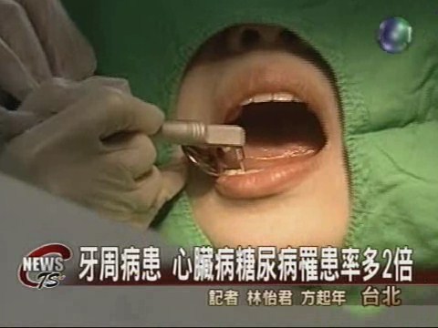 罹患牙周病 多種病上身 | 華視新聞