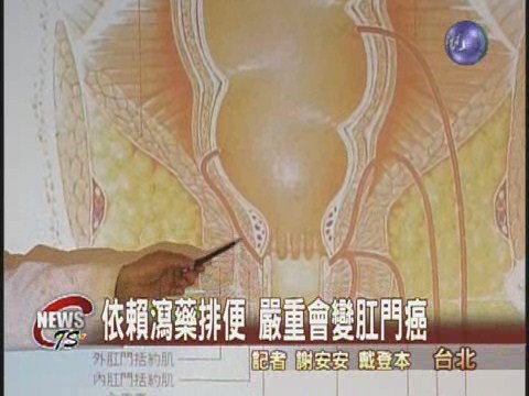 排便不順吃瀉藥 小心引發肛門癌 | 華視新聞