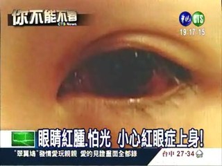 紅眼症拉警報 急診病患暴增15倍