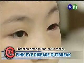 Pink Eye Disease Outbreak