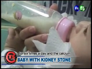 Baby with Kidney Stone