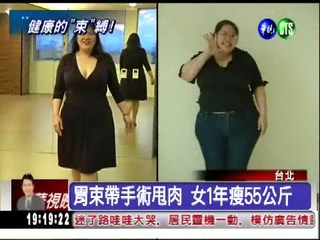 "胃束帶"甩肉 女1年瘦55公斤