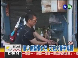 女兒提汽油滑跤 噴火槍爆灼身