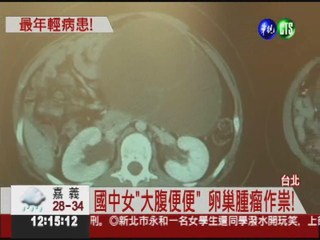 卵巢腫瘤"搞鬼"! 國中女長期便秘