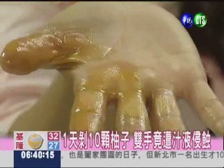 剝柚子沒洗手 手嚴重脫皮還長斑