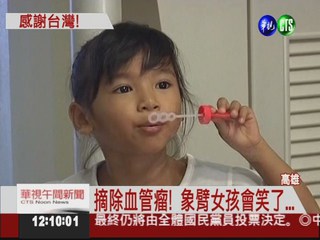 台灣醫療團幫忙 象臂女孩變美了!