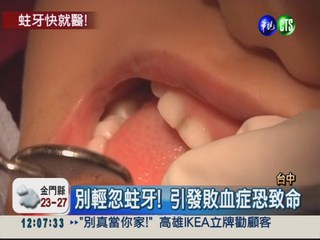 蛀牙引發蜂窩性組織炎 拔牙救命