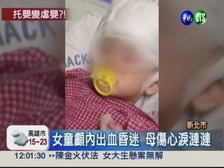 2歲女童疑遭虐 顱內出血昏迷1週
