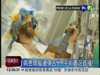 病患開腦邊彈吉他 手術實況直播!