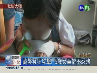 藏獒撲倒5歲女童 兩頰險被咬爛