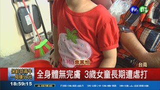 狠爸後媽丟出門 3歲女混身傷