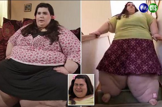 300公斤女米其林 我胖的像怪物 | 華視新聞