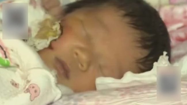 驚悚! 小女嬰臉被咬掉 生母幹的? | 華視新聞