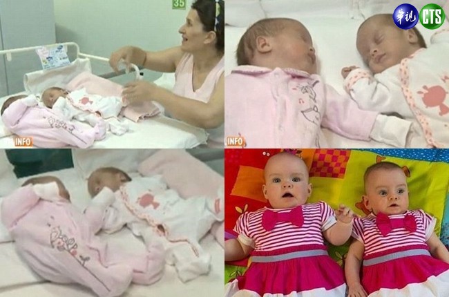 罕見雙胞胎 出生日期隔了二個月 | 華視新聞